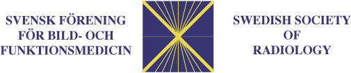 SFBFM